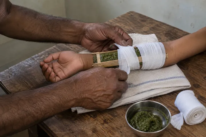 Herbal dressing and bandaging of an injured arm