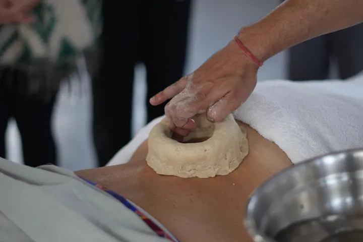 Warm medicated oil held in a dough ring on the back (Vasti treatment)